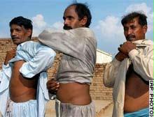 مزارعون في باكستان أتجروا في الكلى
