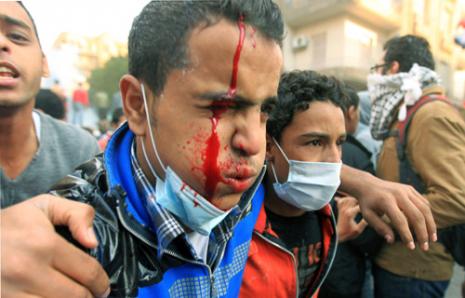 القنّاصون يستهدفون العيون في ميدان التحرير (خالد الدسوقي ــ أ ف ب)