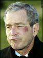بوش في حالة ثمالة والكدمات واضحة على وجهه 